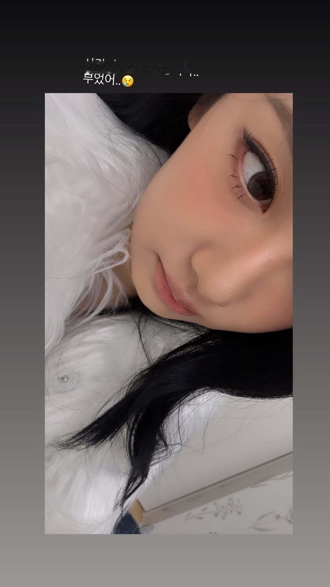 251103 imnotningning IG Story「都怪..智齿..好难