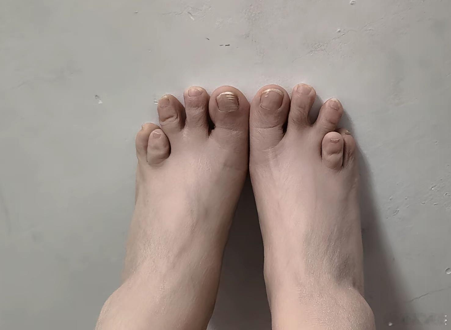 比较特殊的脚~~[吃惊] ​​​