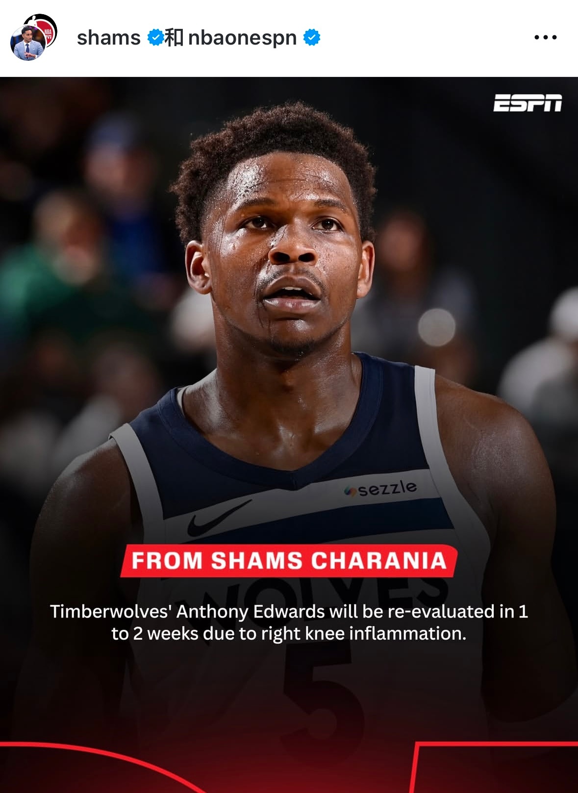 爱德华兹因右膝炎症将接受进一步观察，并计划在1至2周后进行复查，以评估恢复情况。