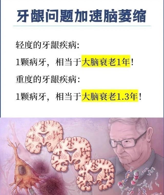 牙齿会影响整个身体健康 牙齿疾病会加剧身体负担引起衰老。 