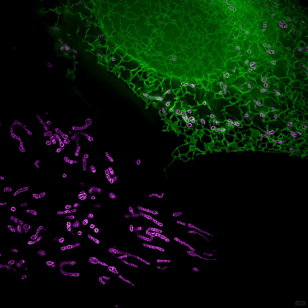 线粒体和内质网，好看但是不在一起👿