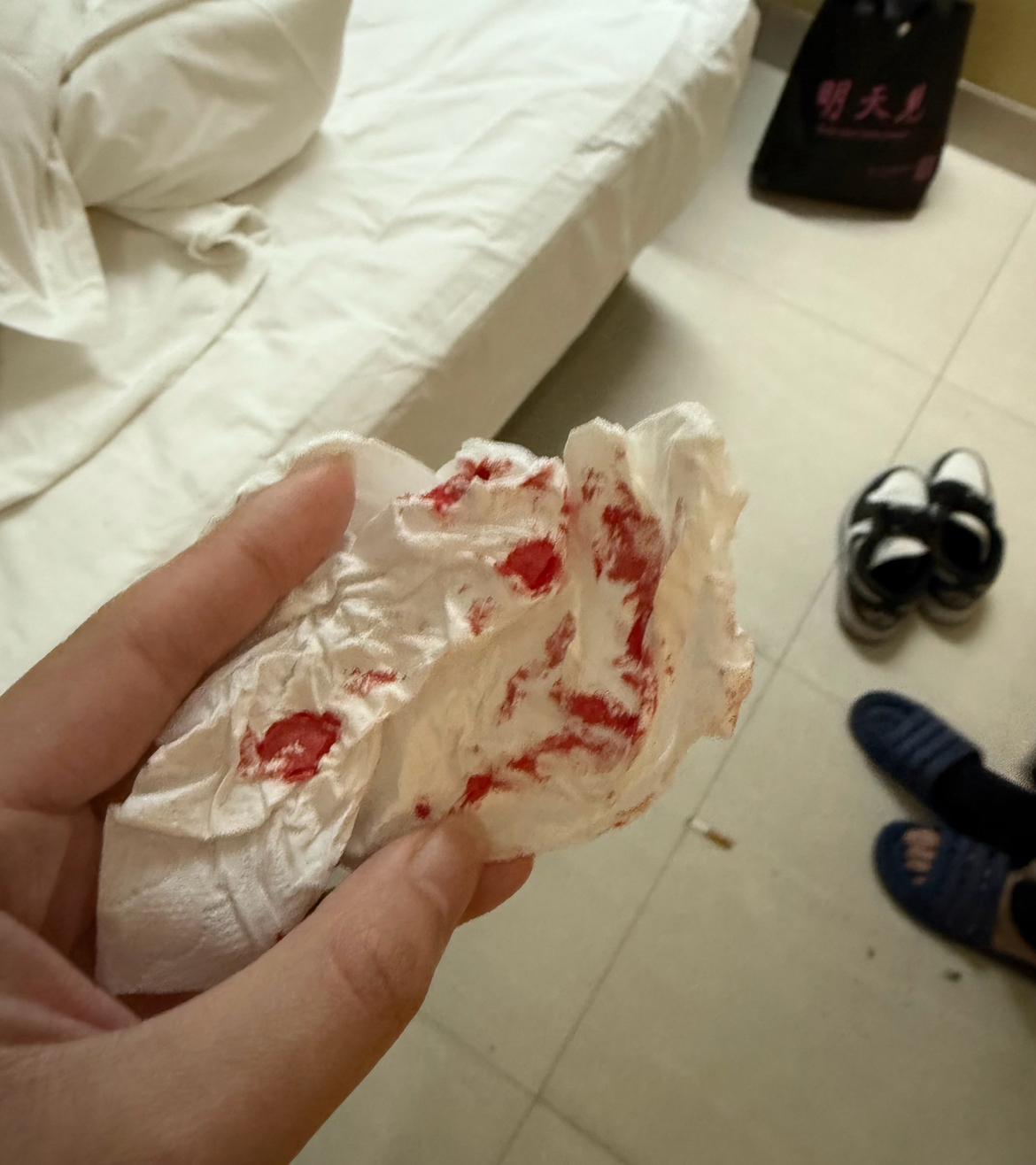 9月25日，上海发生一起离奇事件。一名男子住店时，半夜耳朵突然剧痛，还流了血，医