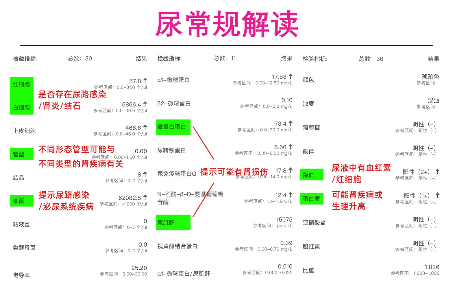 60s看懂尿常规，一张图就够了