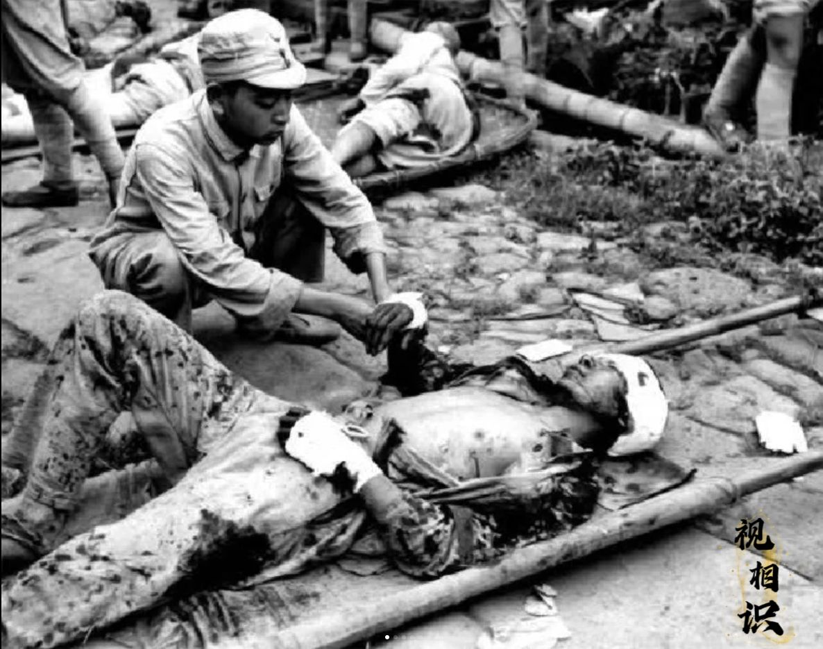 1944年，云南腾冲，一名受伤的抗战将士的照片，镜头中他躺在担架上，衣服上到处是...