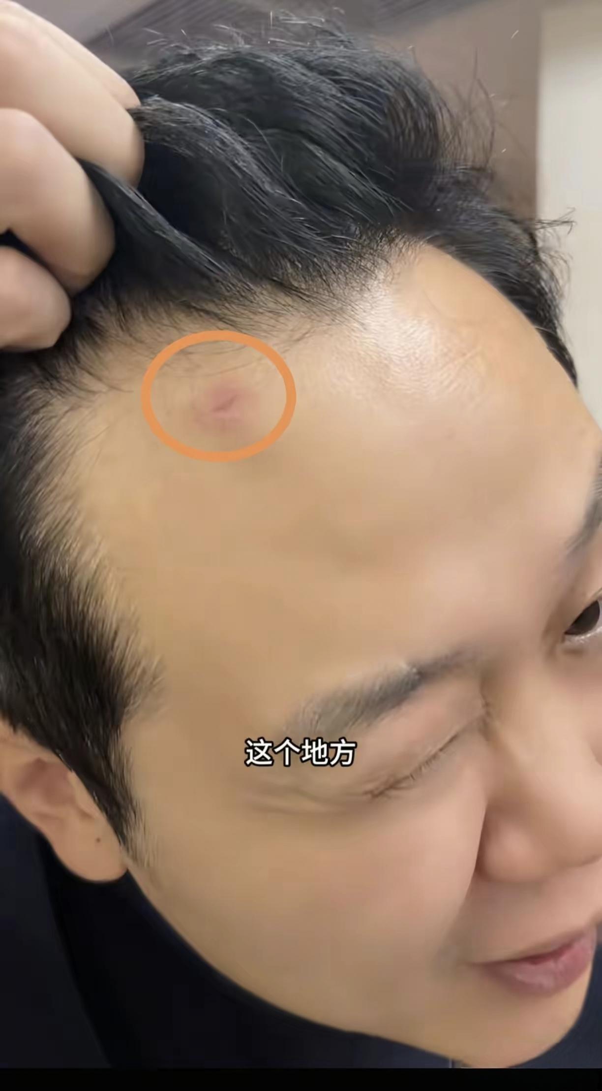 出事了！
 
6月12日，两名中国球迷李先生和王先生向媒体讲述了他们在墨西哥的惊