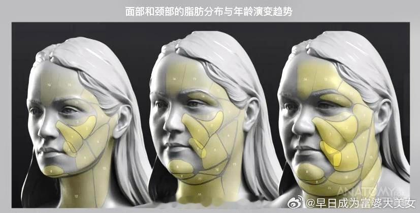 看这张图知道了减肥应该可以改善眼眶上部脂肪堆积的问题 ​​​
