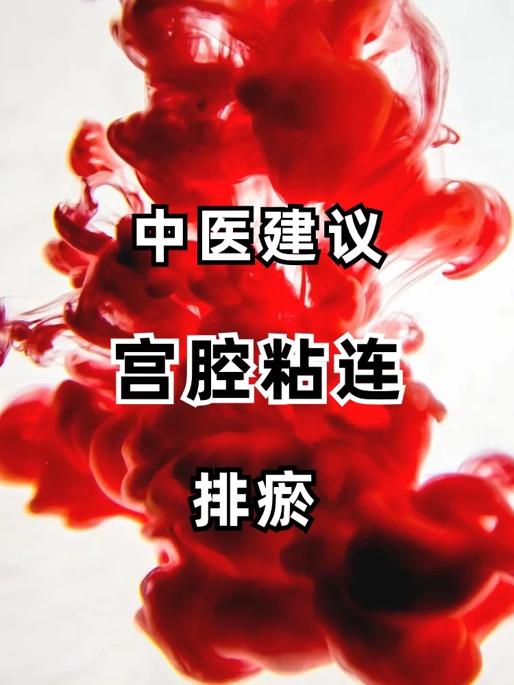 宫腔粘连，要排瘀❗