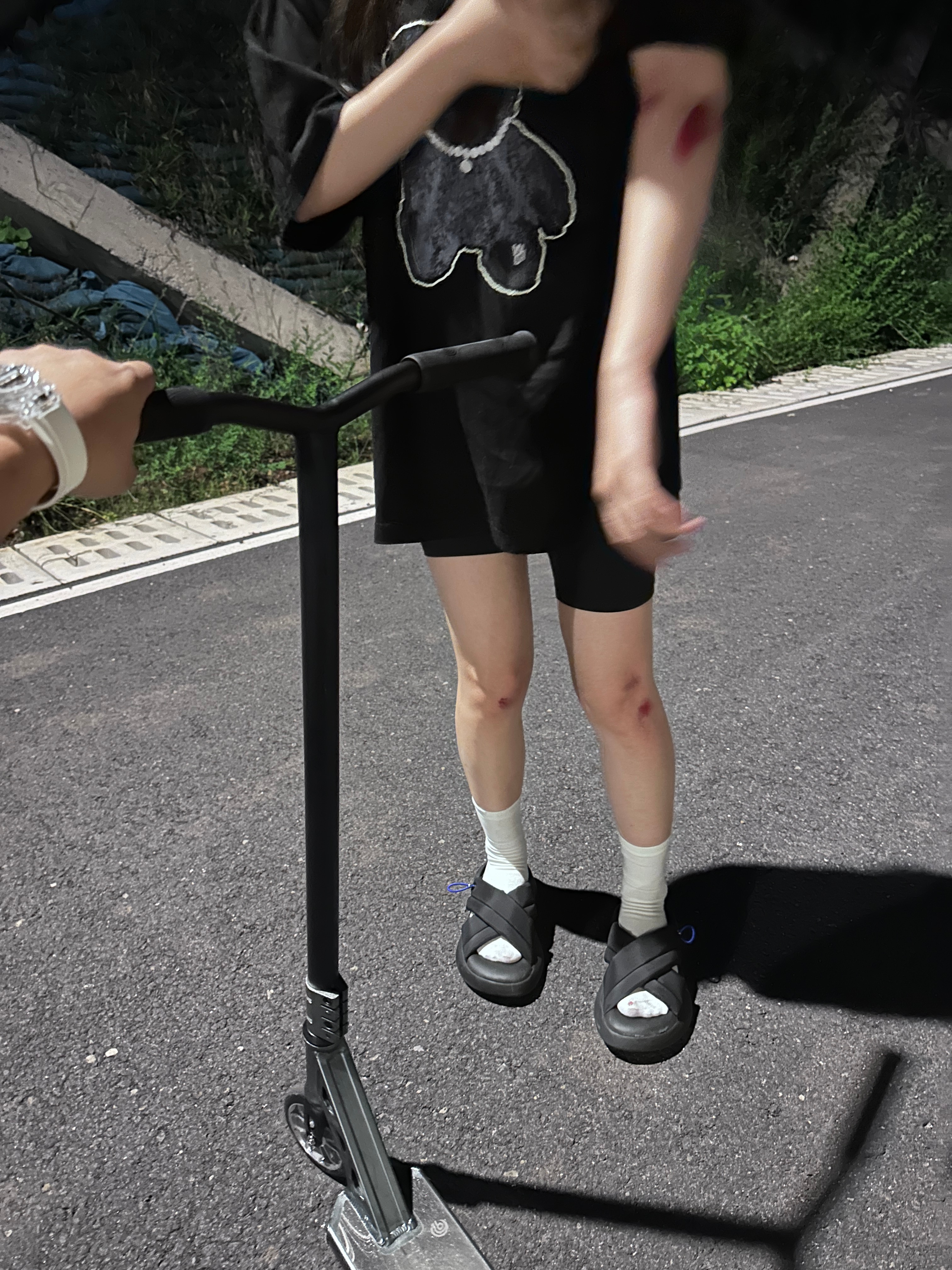 滑板车惨案我真服了我媳妇了….. ​​​