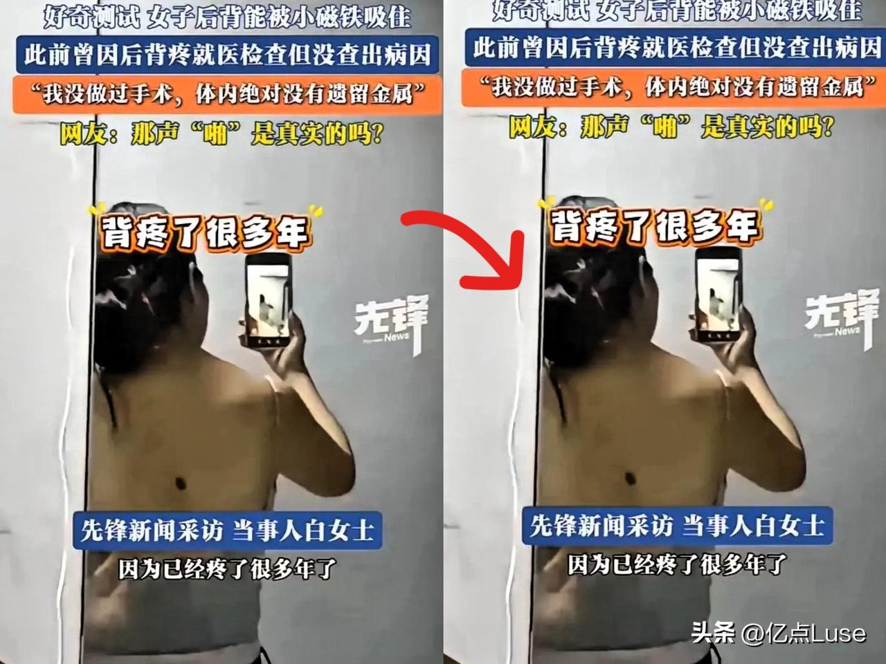 科学无法解释！
河南信阳一名女子生完孩子后，后背常年疼痛。她称自己从未做过手术，
