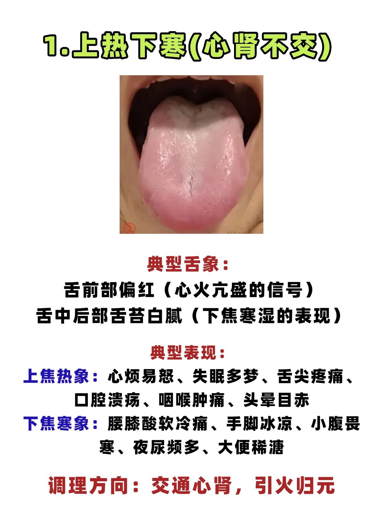 既怕冷又怕热，多半是阴阳两虚，常见的3种舌象！