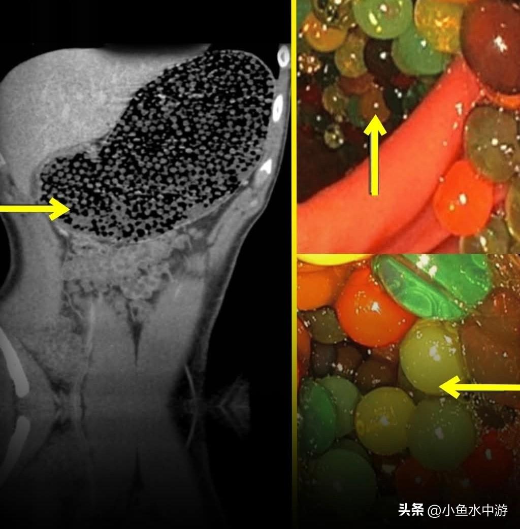 发表在《Cureus 医学科学期刊》（Cureus Journal of Med