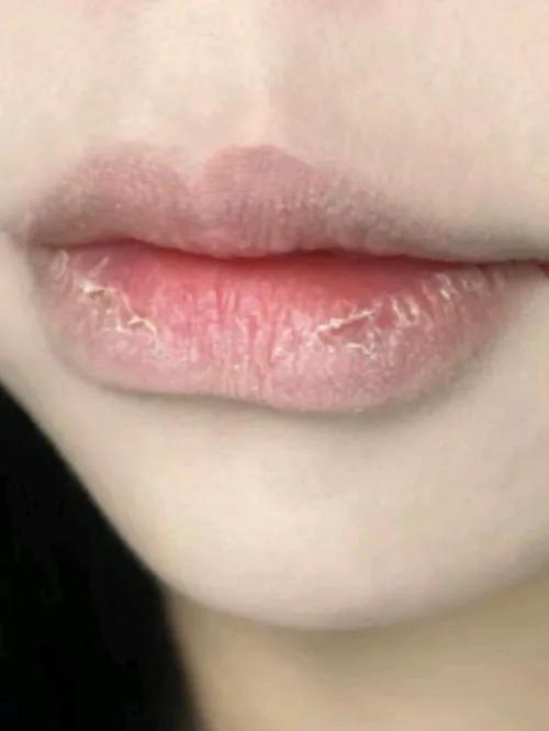 冬天嘴唇老是干裂起皮，涂润唇膏似乎也没啥作用，这是因为啥呢？

自前两天接连吃了