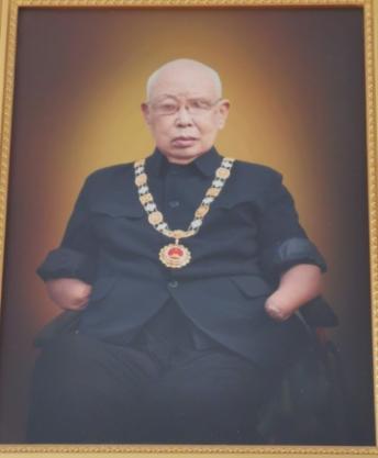 他历经47次手术，昏迷了93天，四肢全被截掉，左眼摘除，右眼也几乎失明，重生后身