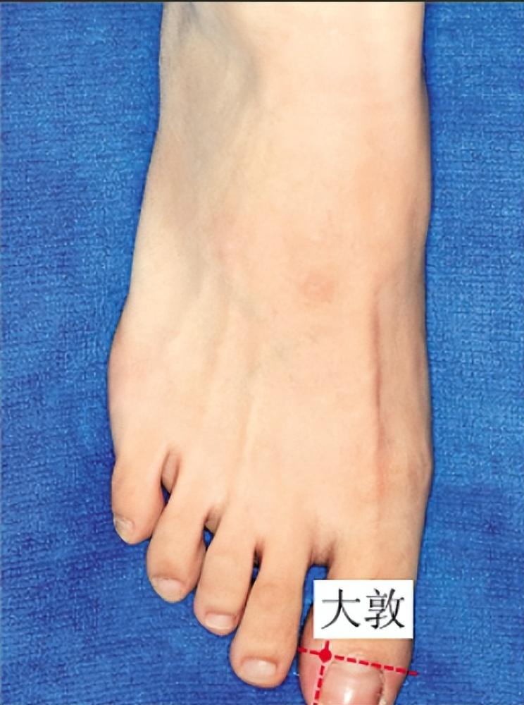 大敦穴 —— 养肝 “消气穴”，常按不生气、不抱怨、心情顺
提示：本内容仅供健康