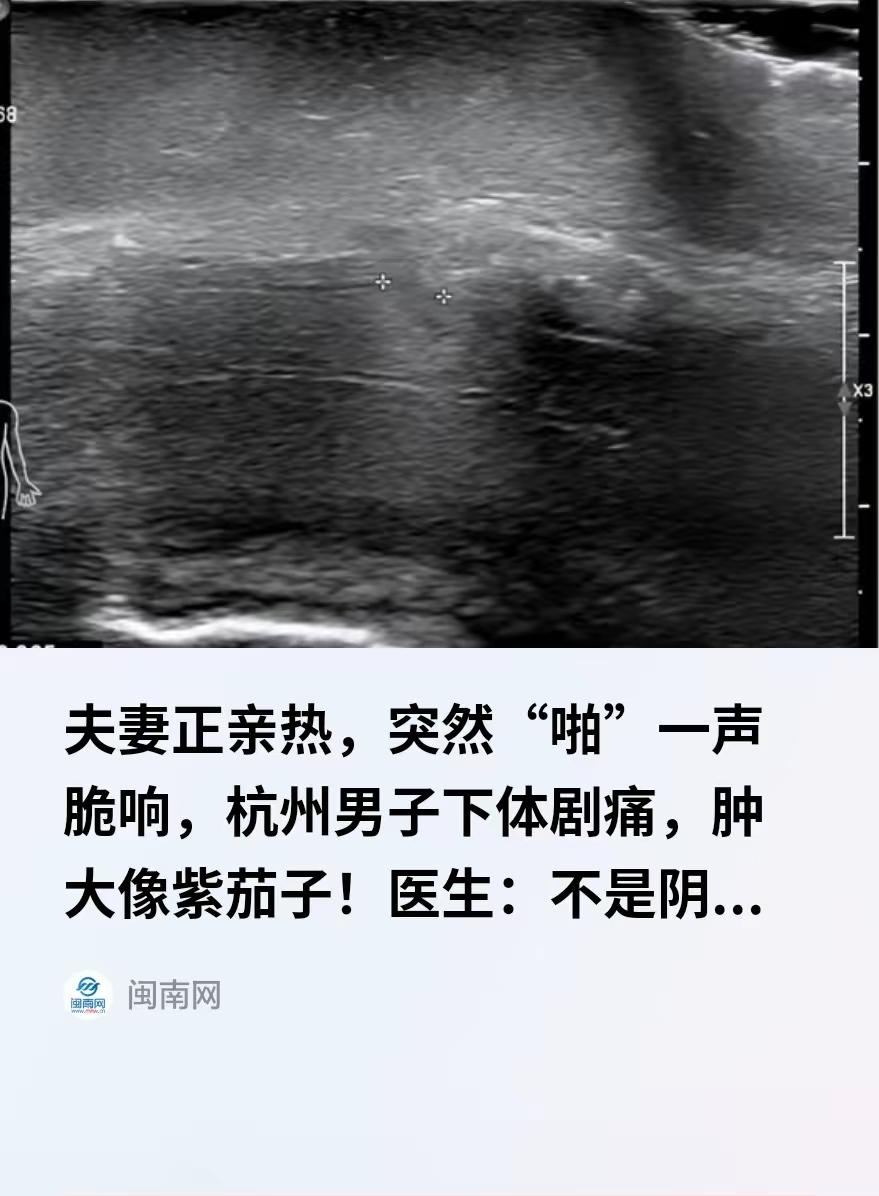 “光听着就疼！”浙江杭州，一49岁男子和妻子同房亲热时，动作猛了些，突然“啪”一
