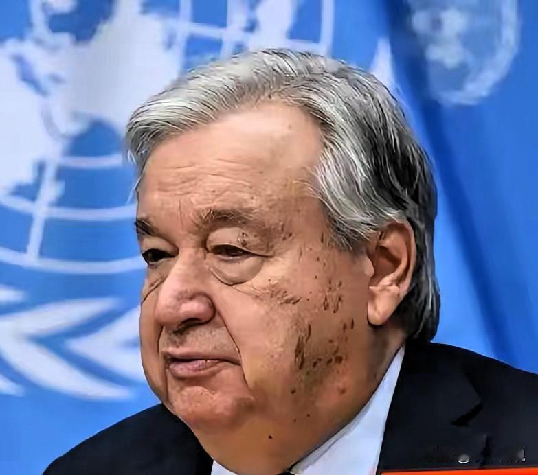 快讯，联合国终于声明了!
谁懂啊！美军凌晨突袭委内瑞拉，把熟睡的马杜罗夫妇从军营