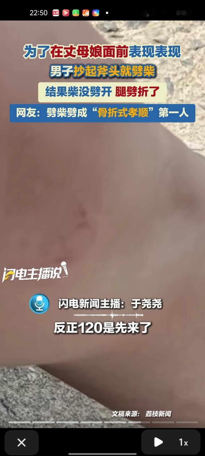 近日，黄冈麻城市。男子去丈母娘家，想劈柴好好表现一番，结果打到自己的大腿上导致骨