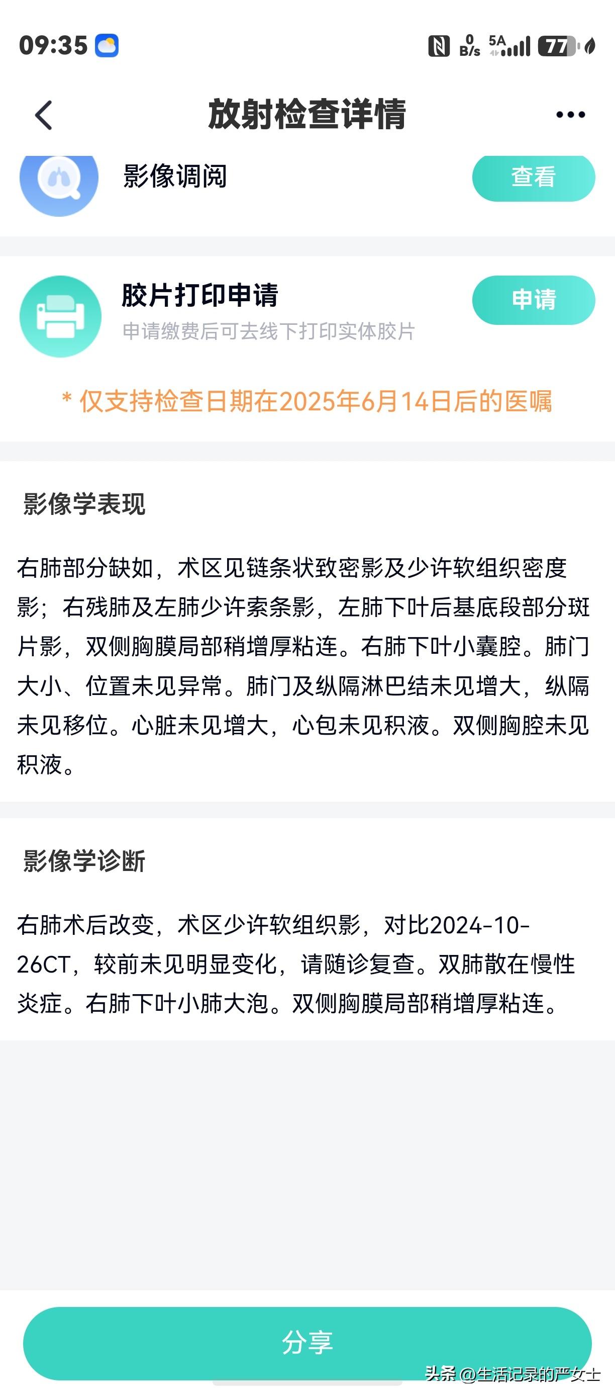 今天胸部CT扫描的报告岀来了，看了结果心里终于松了一口气。

我一直觉得我的肺不