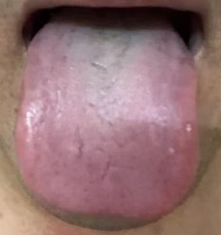 精血亏虚又寒湿重？中医调理要标本兼顾







很多朋友年纪轻轻伤精过度，如