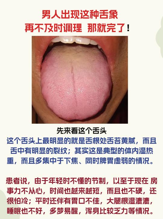 出现这样的舌象，再不去及时调理，那就完了