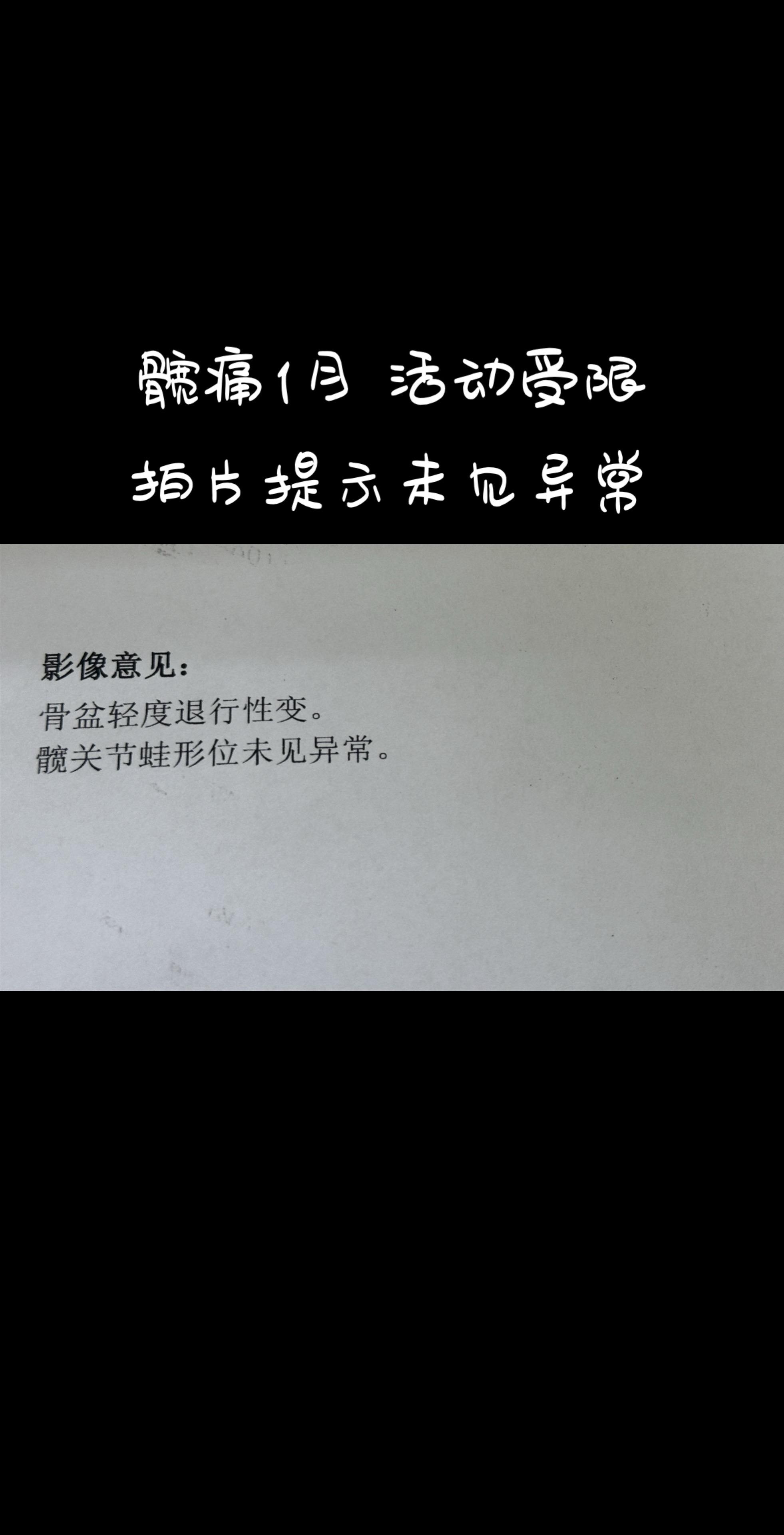 这种髋痛要警惕什么问题。髋痛并不都是滑膜炎