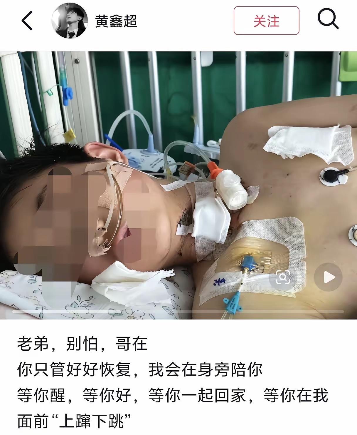 真的揪着心看完整个事，直到看到男孩脱离危险转入普通病房的消息，才敢长长舒一口气，