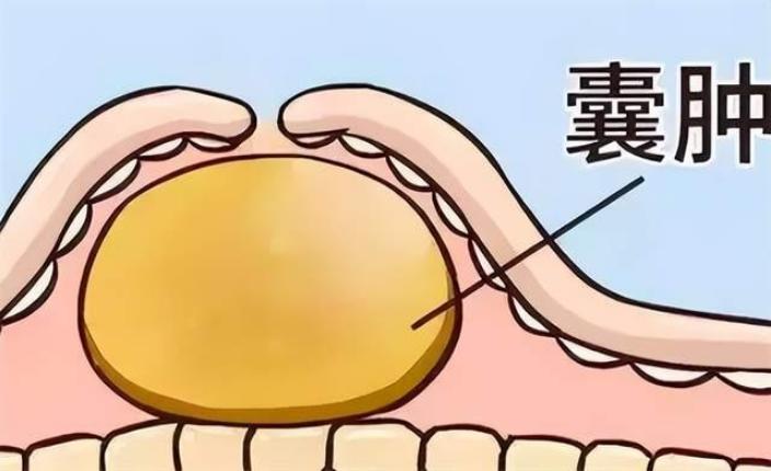 逍遥丸的“黄金”用法，这样搭配，能够通一身淤血，散一身结节！赶快收藏吧[给力][