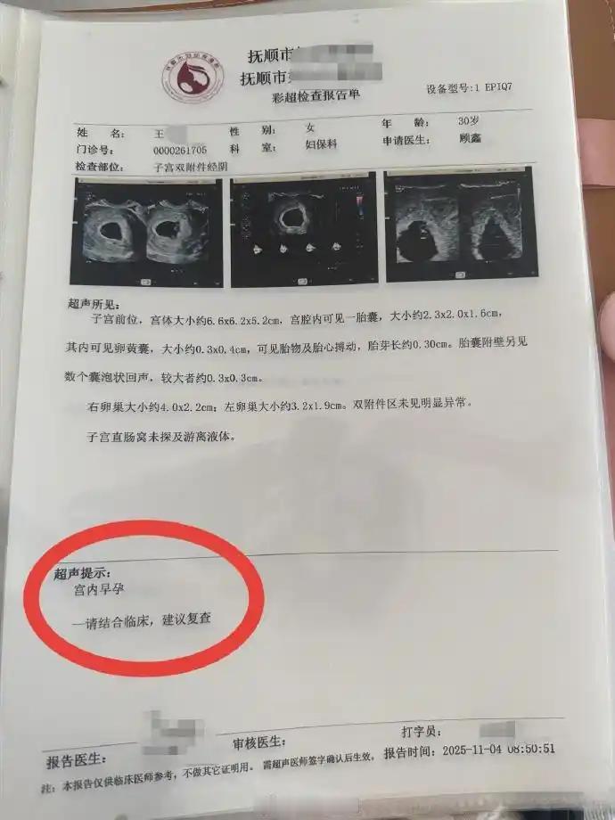 活久见！辽宁抚顺，女子怀孕后去做产检，可令她没想到的是，每做一次产检，彩超单上都