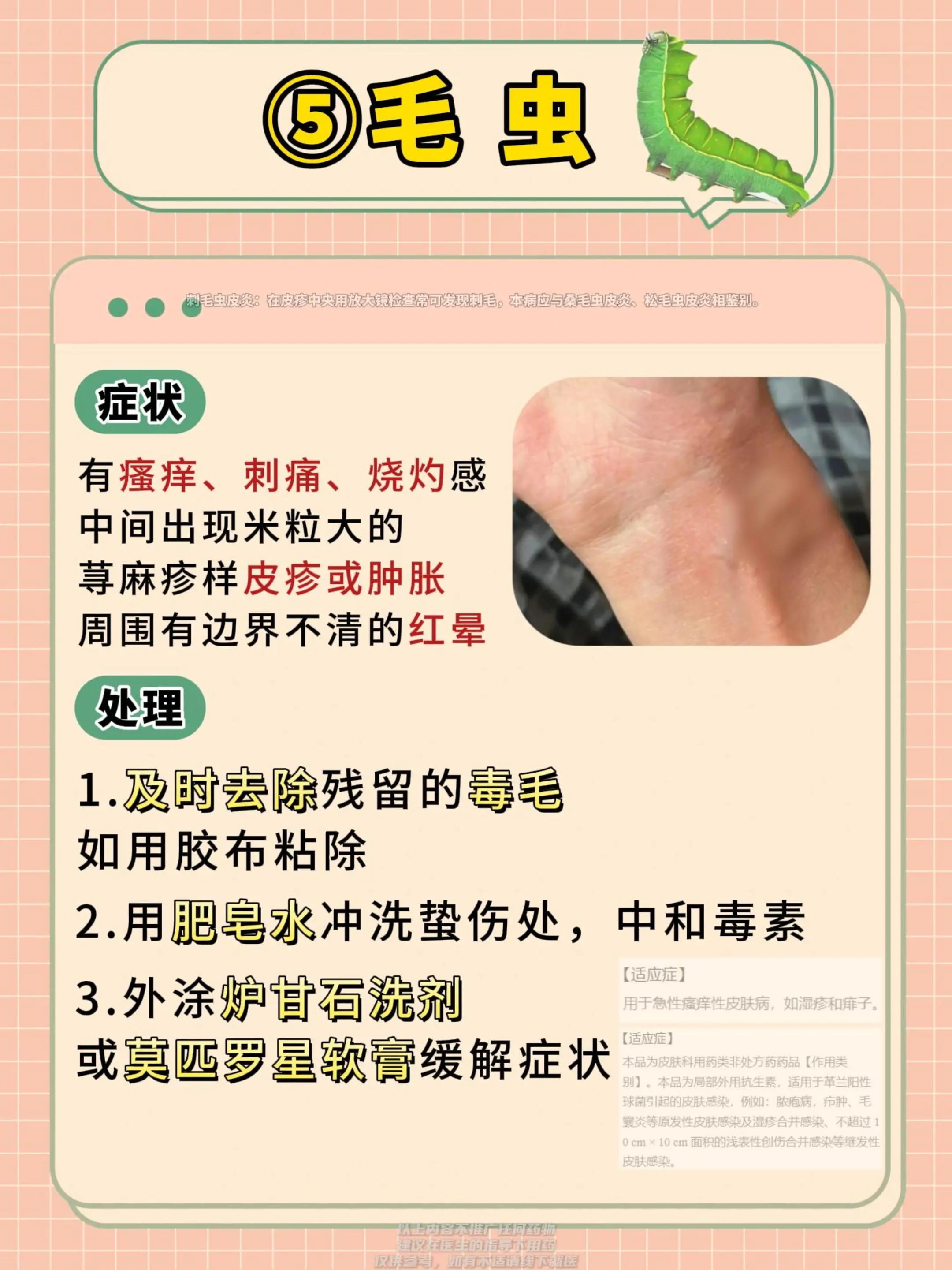 虫咬皮炎处理合集。被各种虫咬了怎么处理？建议收藏，以后可能用得到医学科普创作灵感