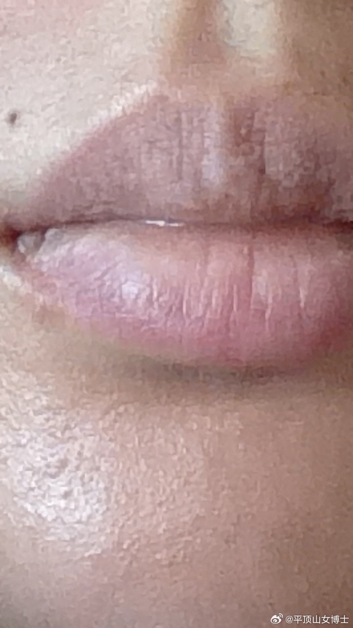 凤体欠安，我个人认为世界上最让我舒服的感冒药是999感冒灵，但是我们这边卖断货了
