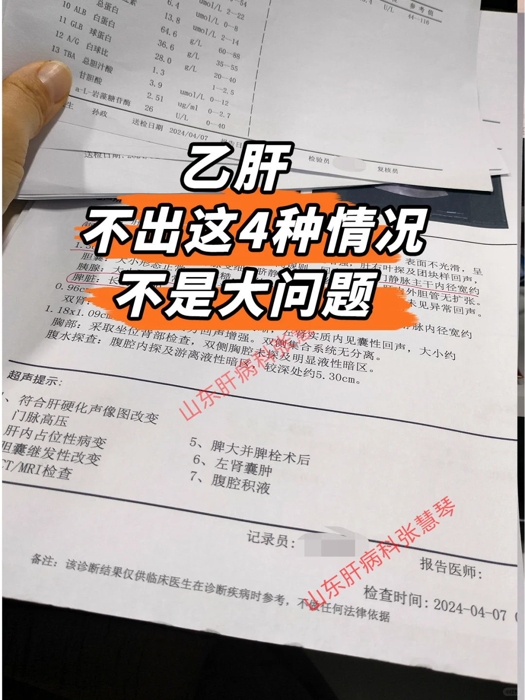 乙肝患者，不出现这4种情况，都不是大问题