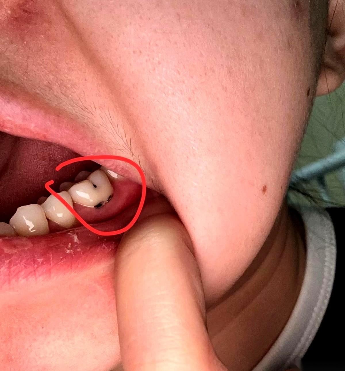 每天早上叫醒我的不是梦想，是我嘴里那颗烂牙的味儿。
真的，不夸张。
就是那种……