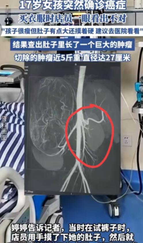 “幸亏发现了！”广东17岁女孩和妈妈一起逛街买衣服，在试裤子的时候，老板娘发觉女