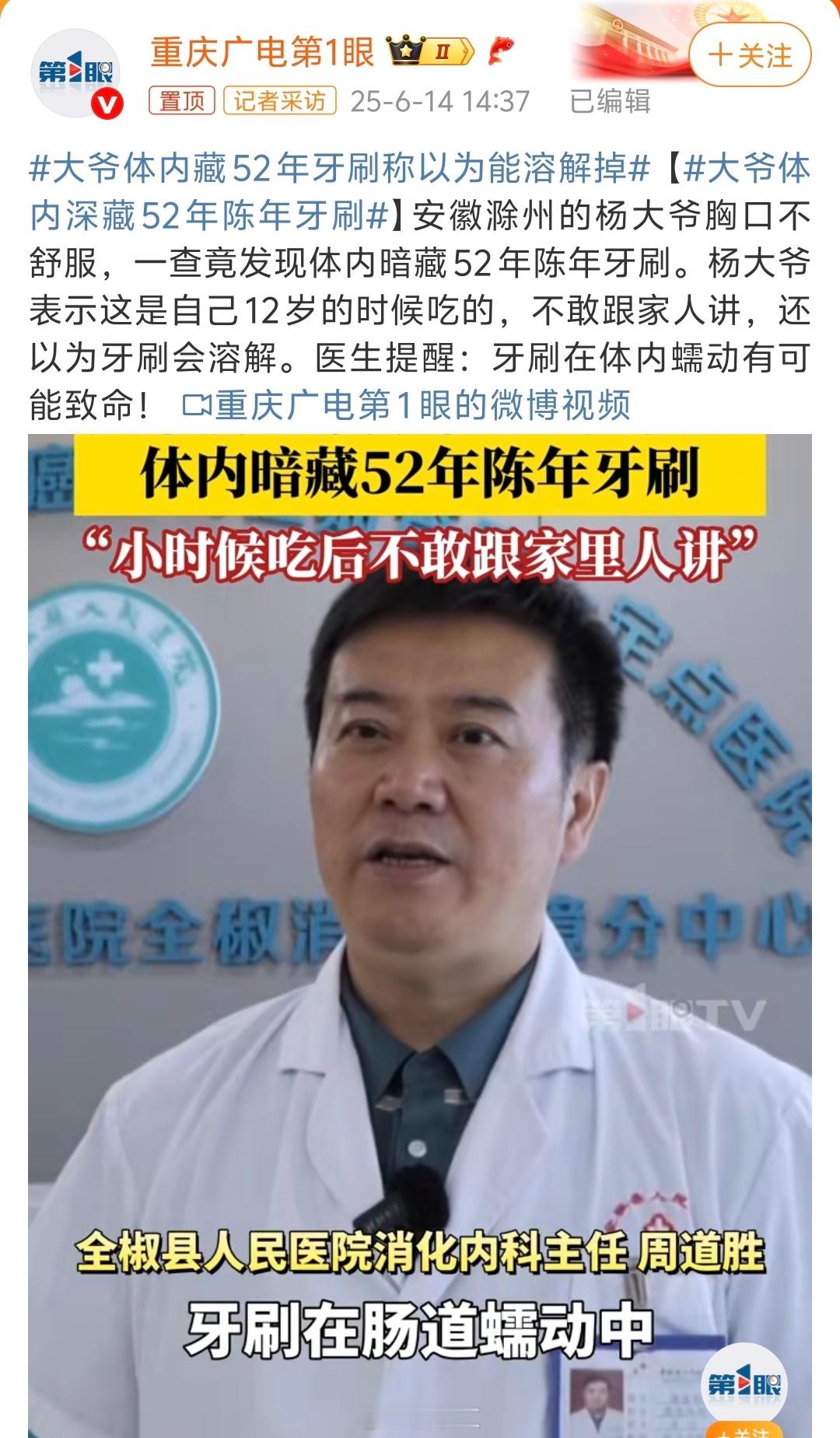 大爷体内藏52年牙刷称以为能溶解掉，这大爷命真大，一把牙刷在体内藏了52年。关键