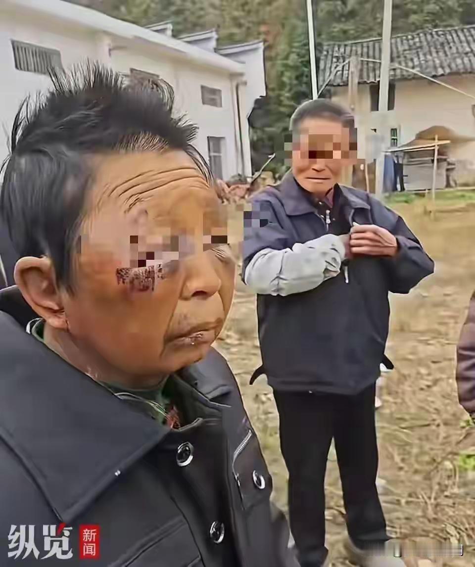 湖南平江一女子遭丈夫多次家暴住院，出院后继续挨打，智力出现问题？当地妇联：多部门