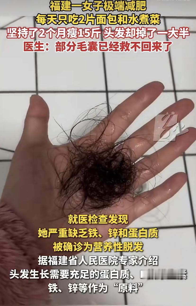 女子每天只吃两片面包和水煮菜，2个月瘦15斤，头发却掉了一大半
福建一姑娘为了减