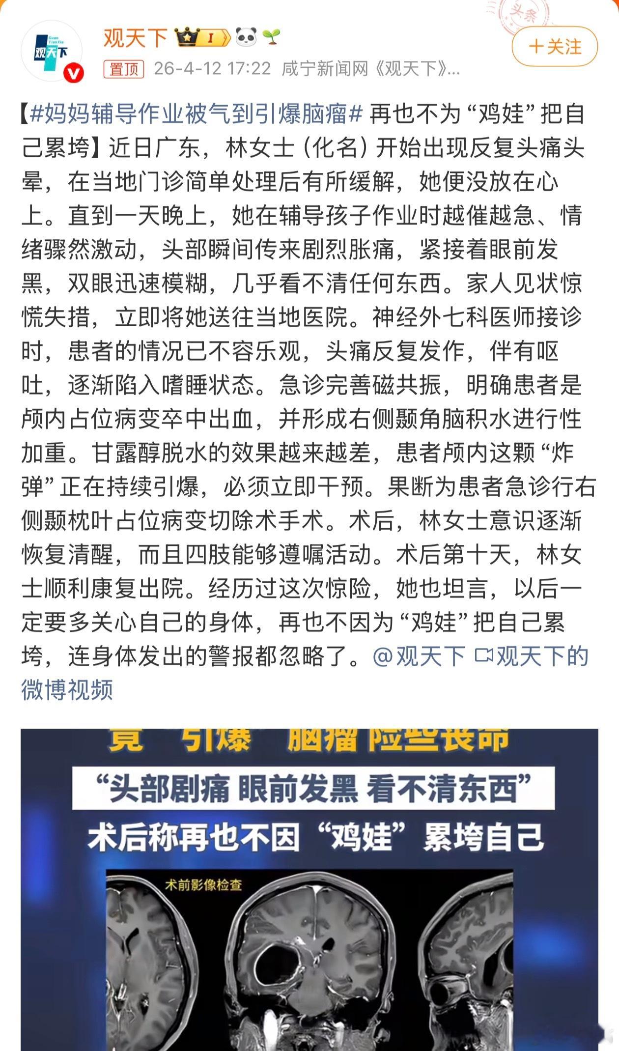妈妈辅导作业被气到引爆脑瘤 我儿子一般是我对象辅导作业，每次她跟我说气死了气死了