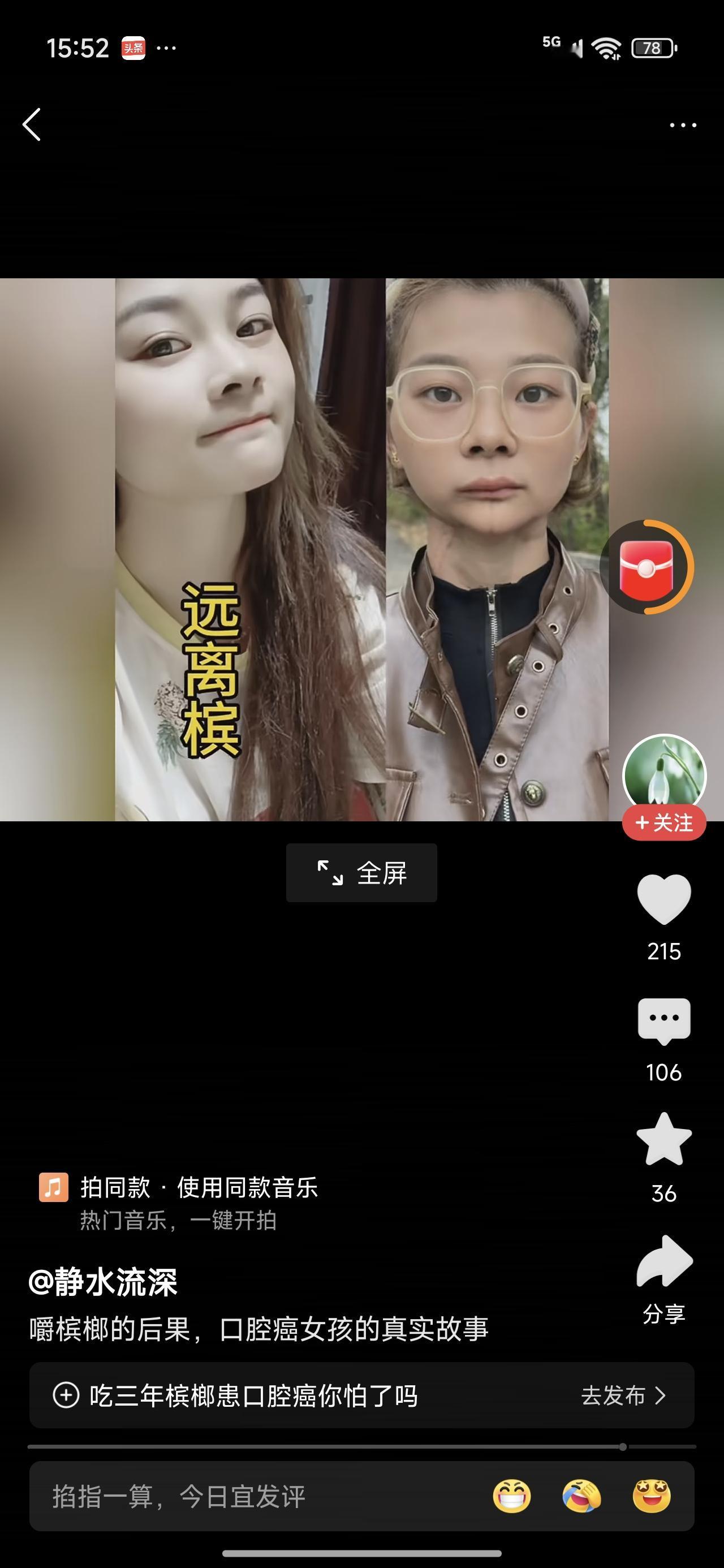 吃槟榔吃成这样子，太惨了。她说有时候吃一两包，有时候吃七八包，一天。
这个东西大