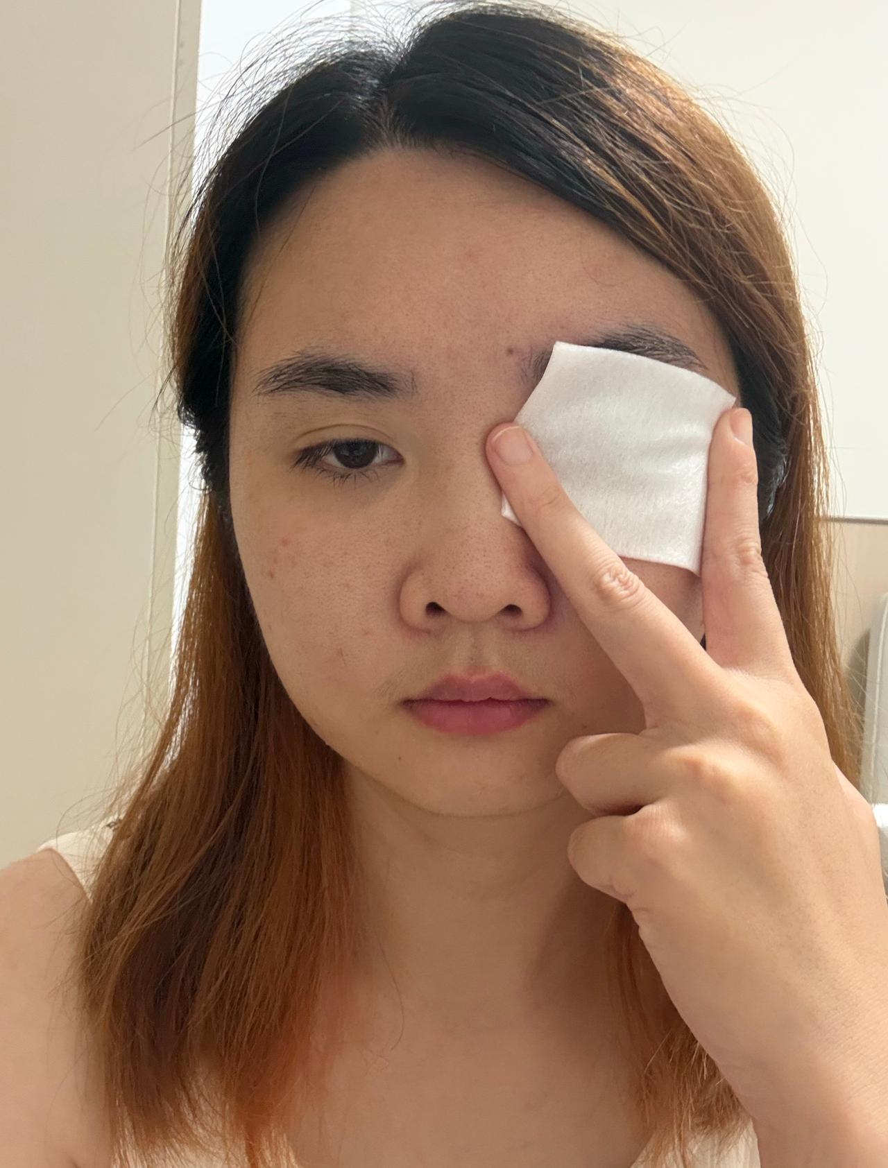 眼睛受伤了要治
不要对好看有什么误解 ​​​