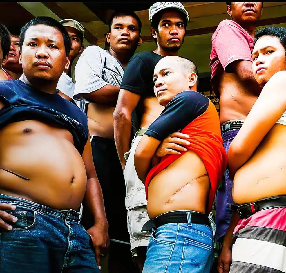 印度也有嘎腰子的“买卖”！
印度警方最近打掉了一个跨境的肾脏贩卖团伙！这个黑心团