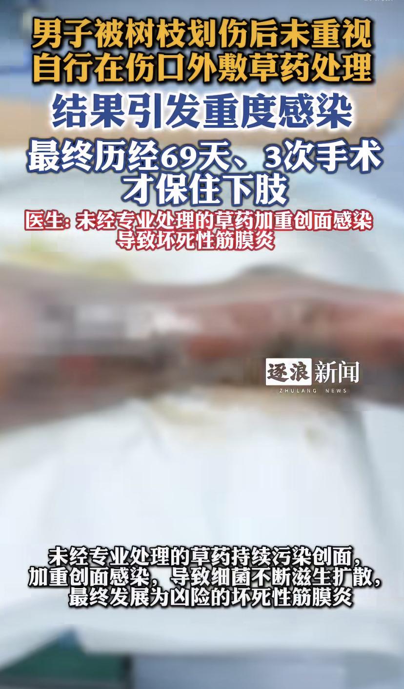 南宁六旬大叔被树枝"亲"了一口，结果在医院躺了69天!
南宁有位61岁的陆大叔，