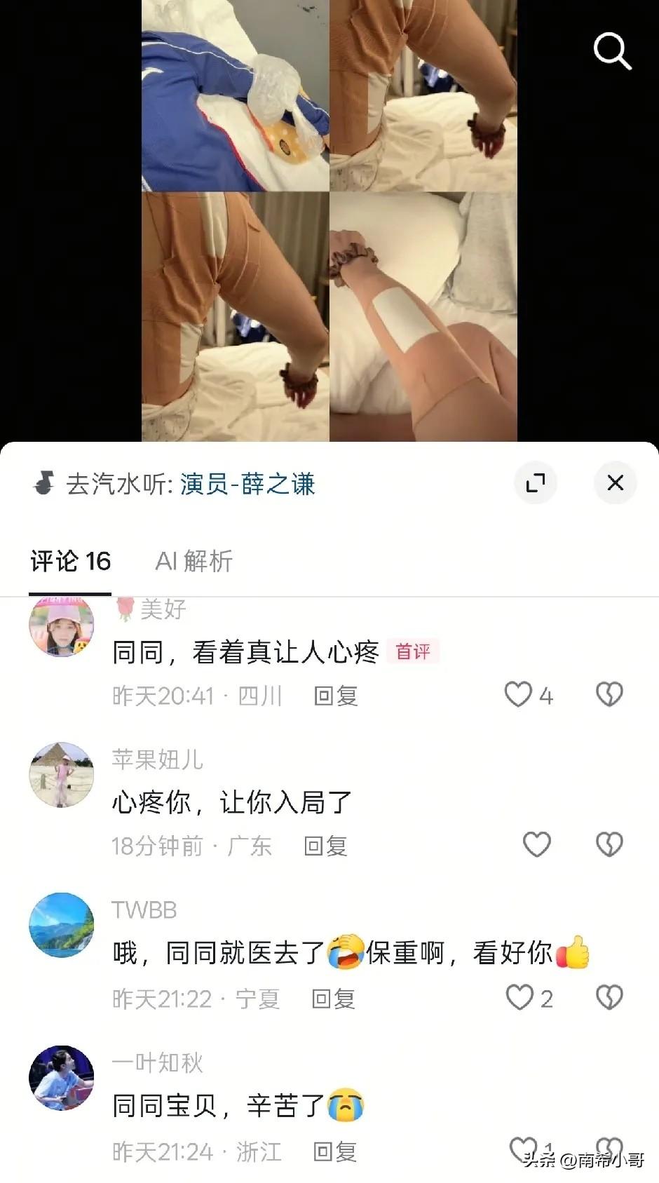 为何说莎莎说因祸得福，
看到陈幸同的胳膊就明白了，

同同在大满贯后，
晒出自己