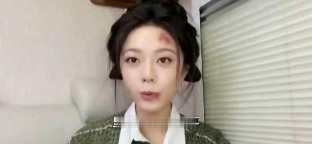 赵今麦顶着受伤妆就来直播了 第一次见演员顶着受伤妆上直播，赵今麦还笑得那么开心，