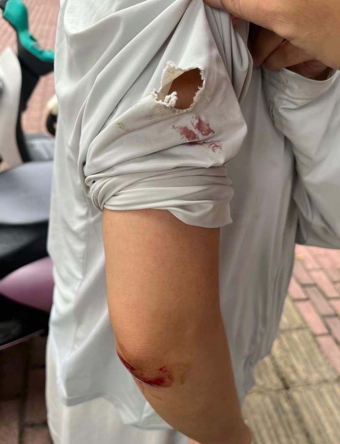【玉林市民被suv轿车撞伤借口挪车跑了】

6月23日，网友爆料称：13号下午3