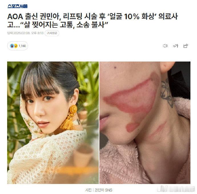 权珉娥做医美导致面度灼伤 据韩媒，权珉娥去医院做睡眠紧致提拉术，醒来后脸上皮肤撕