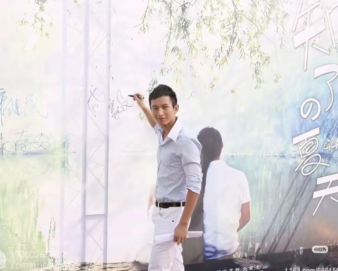 以前年轻的时候，发际线就很高了，颧骨也蛮凸出的 