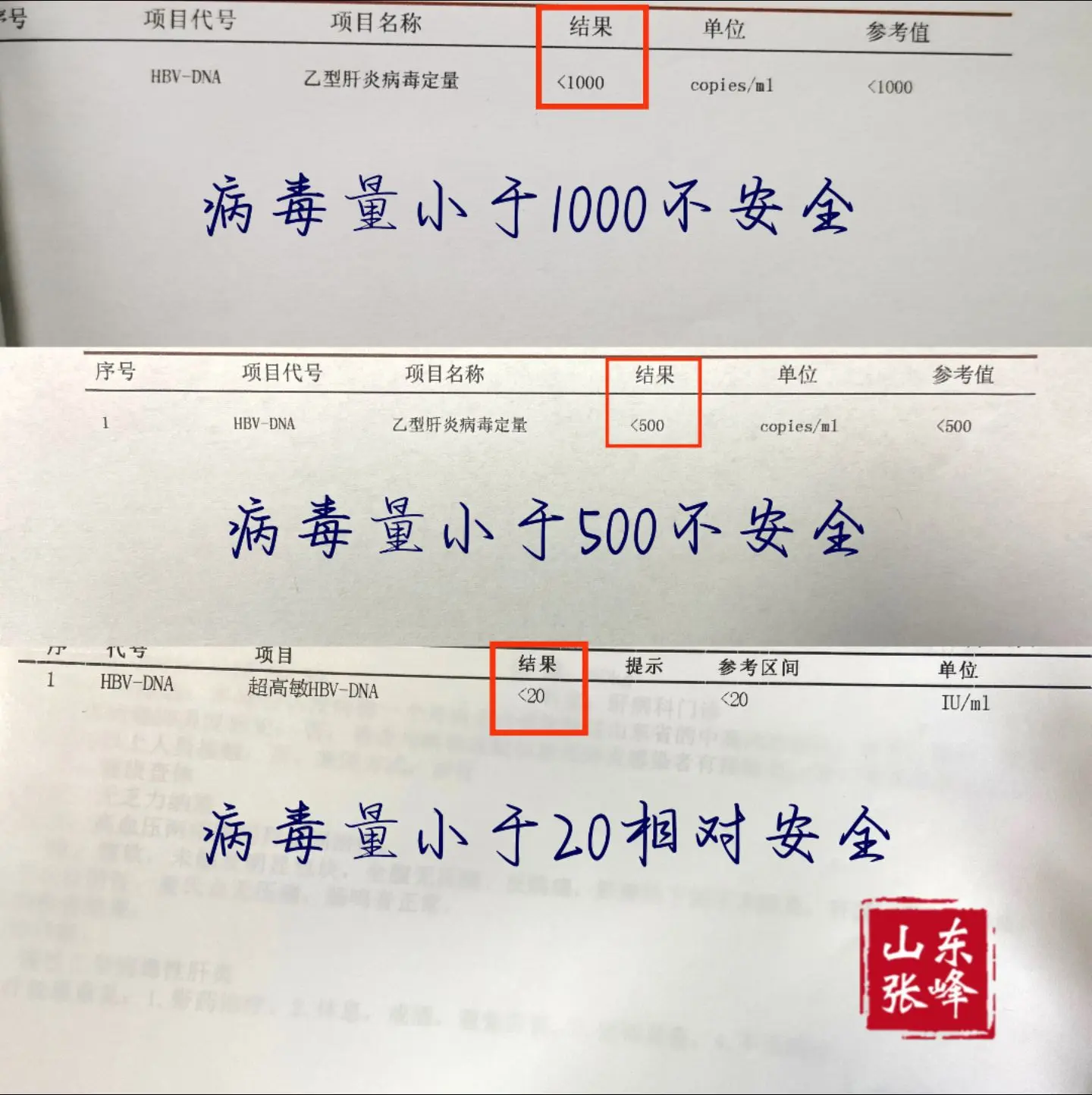 乙肝病毒量低于多少才安全？乙肝