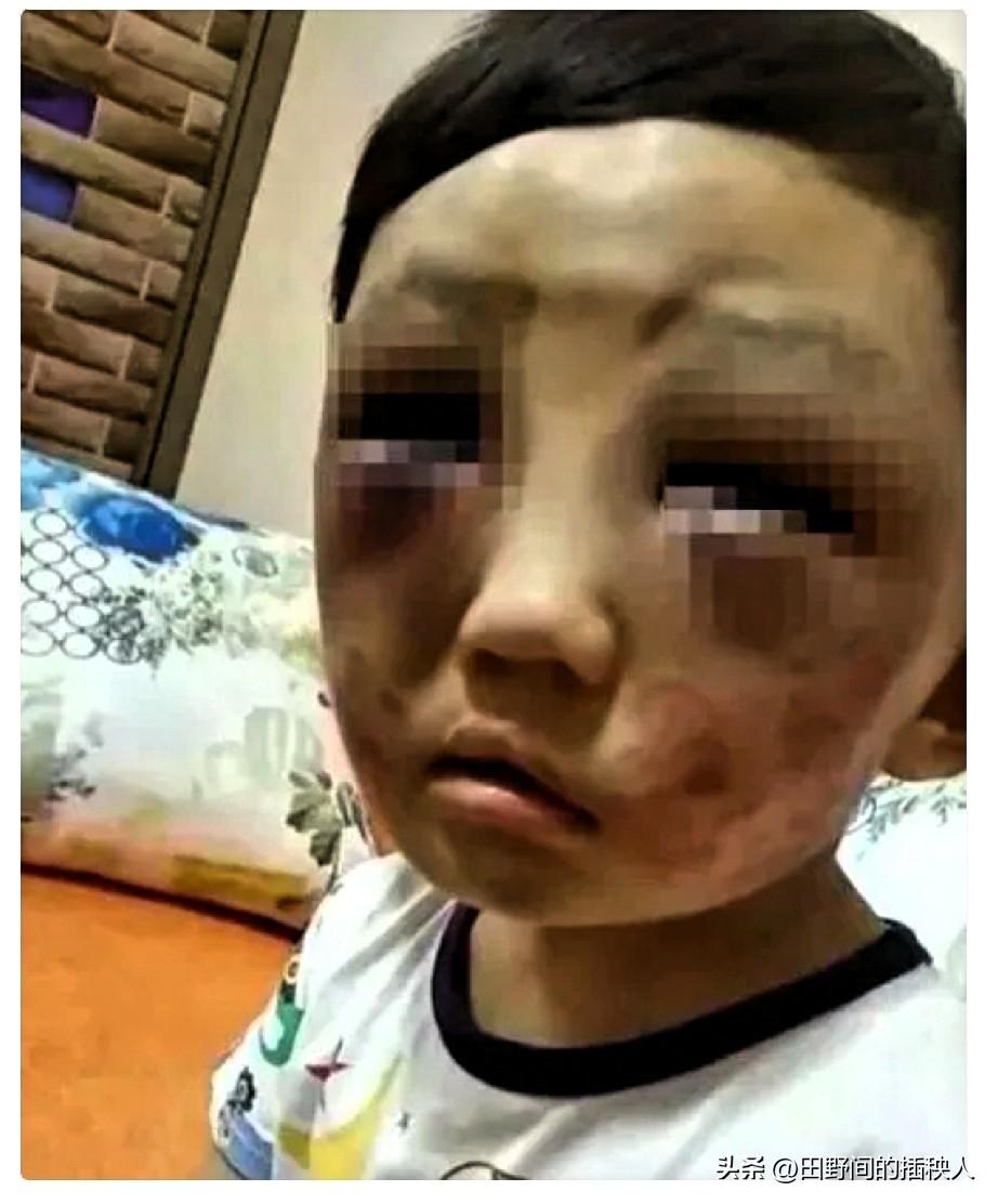 真的被这份没有血缘的父爱暖到了！
 
一位6岁的小男孩，因为跟着爸爸生活时受了委