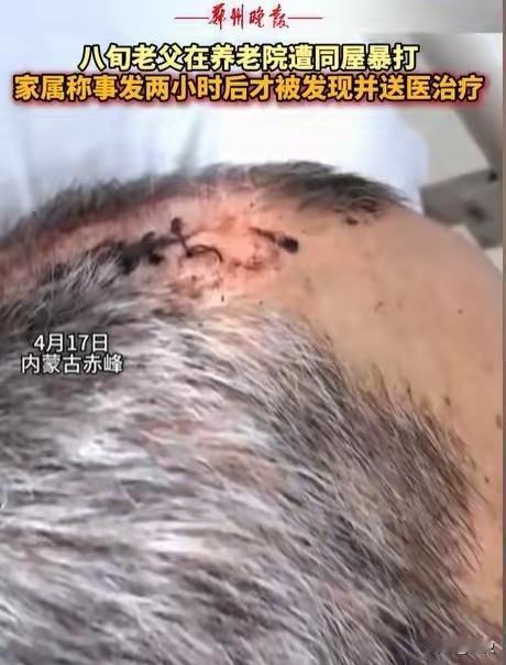 “必须严惩！”内蒙古赤峰，女子将七旬老父亲送到养老院，几天后接父亲，只见父亲裤子
