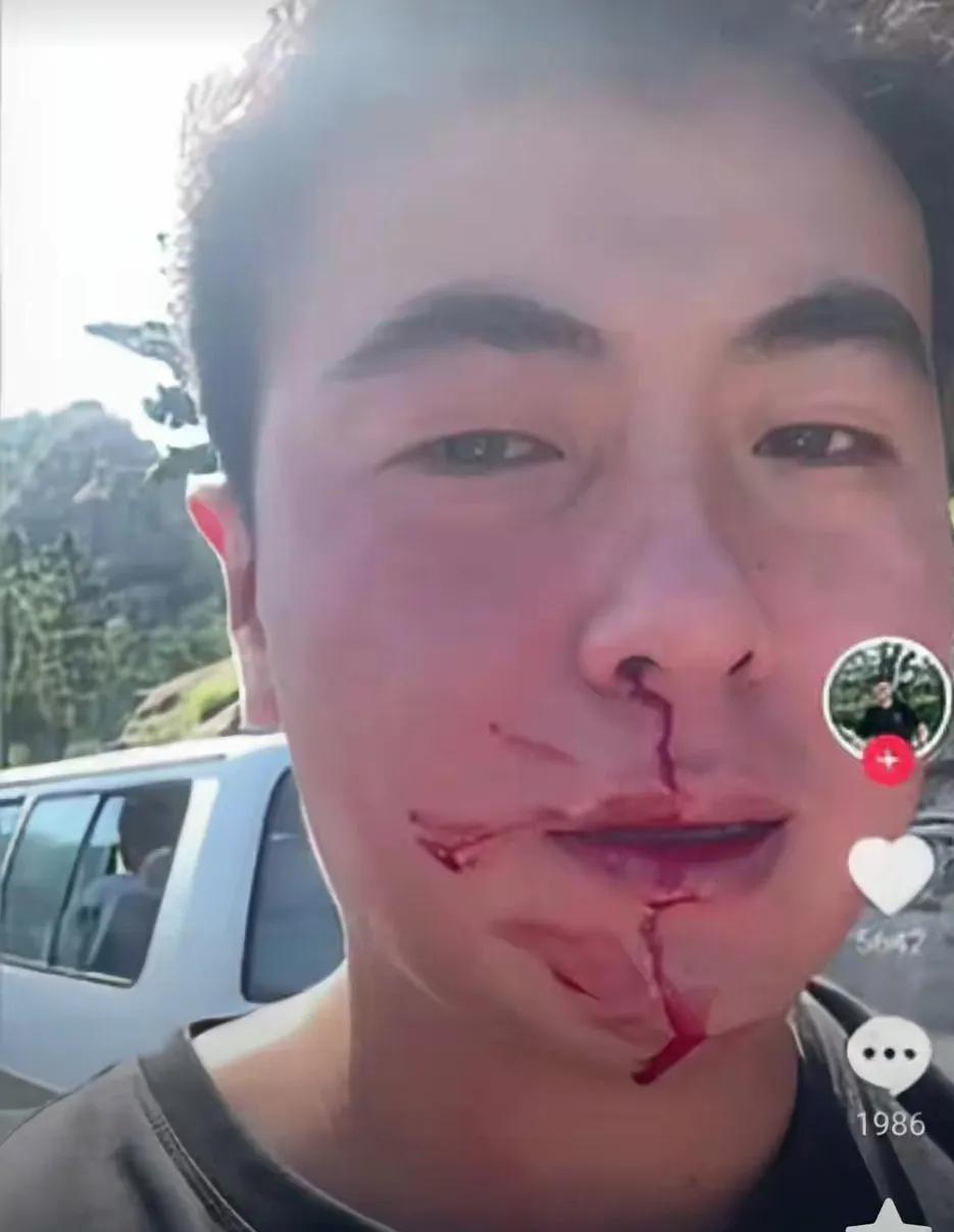 我觉得路虎女打人，这个小伙可以不还手。但必须下车控制住打人女。
因为自己的老婆孩